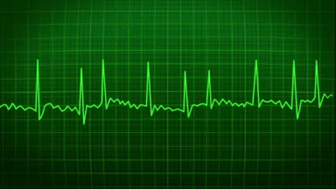 A heartbeat trace scrolling steadily across the screen.
